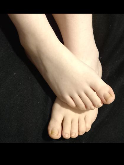 patitasyrodillas OnlyFans picture