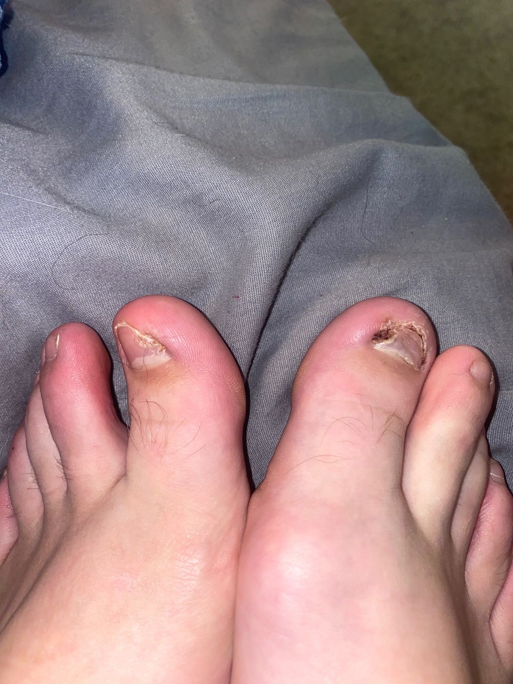 ingrowntoenails OnlyFans profile picture