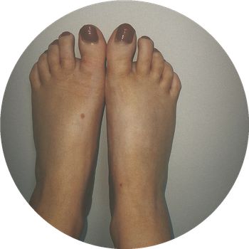 Tinyirishfeet