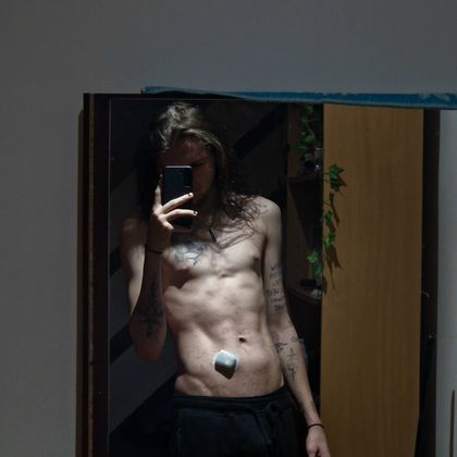ryandiabetesoffical OnlyFans picture