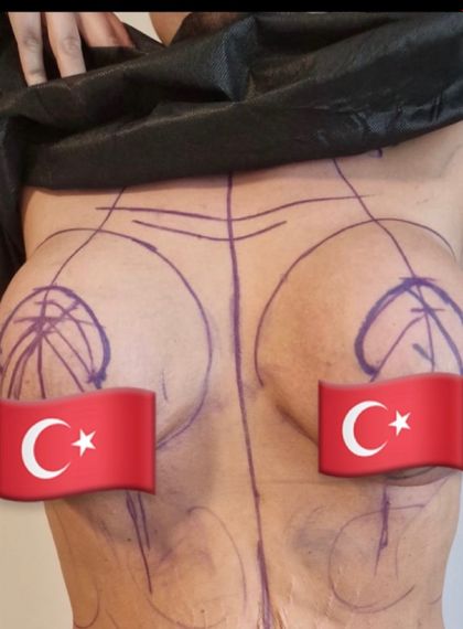 tummytuck0623 OnlyFans picture