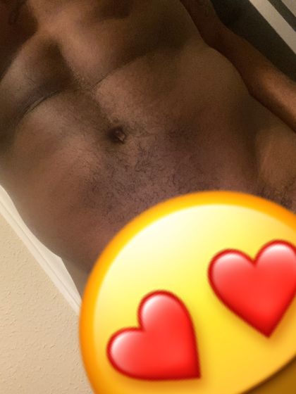 standoutskinn OnlyFans picture