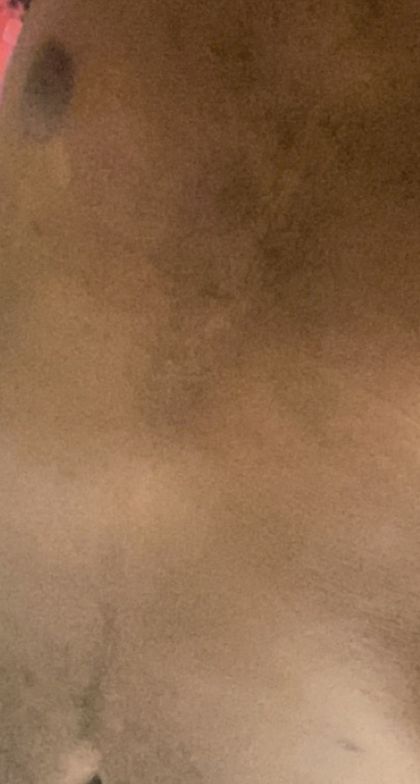cerebralhepoxia OnlyFans picture