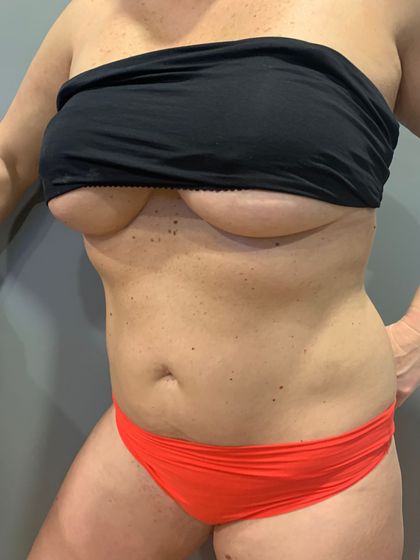 glittermama01 OnlyFans picture