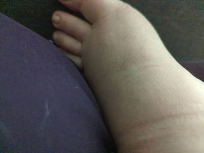 swollen_feet OnlyFans picture