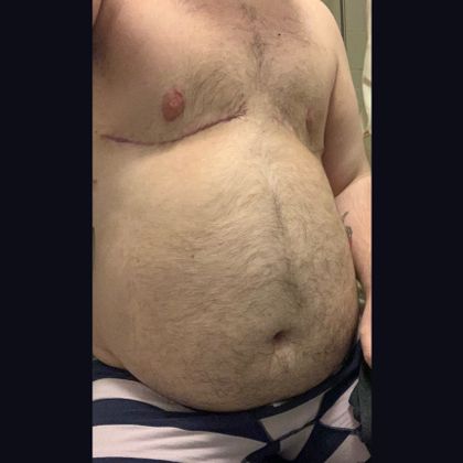ftmunch OnlyFans picture