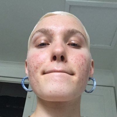 tastytoehoe OnlyFans picture