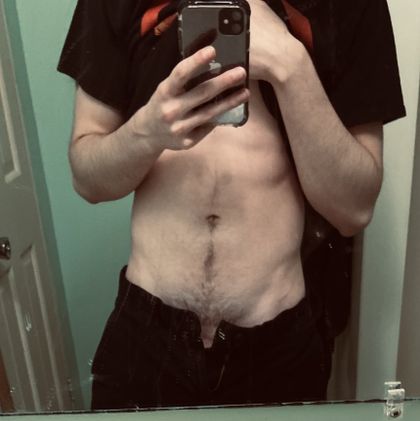 skittle000 OnlyFans picture