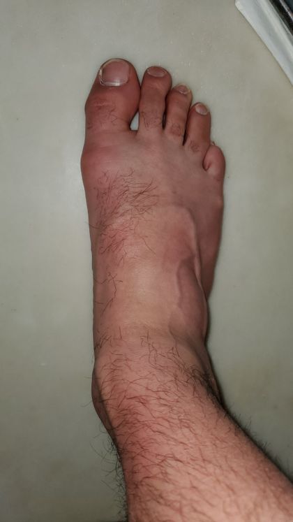 hairyfeet3 OnlyFans picture