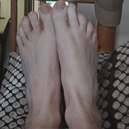 cripplebearxxx OnlyFans picture