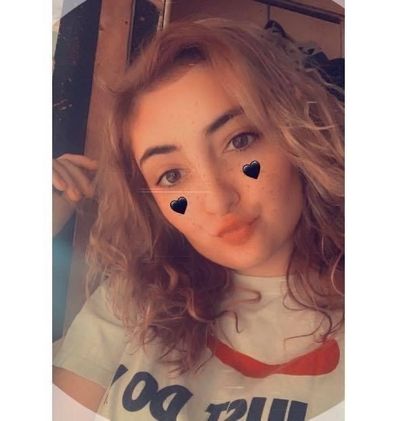 becslit OnlyFans picture