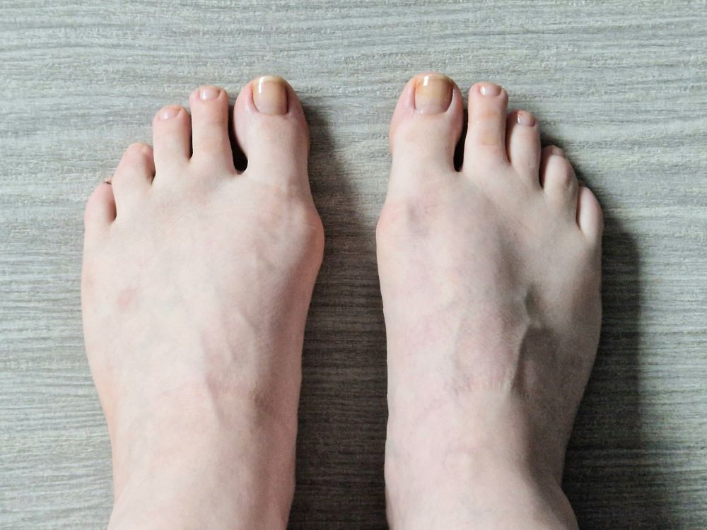 feetbunionsforyou OnlyFans profile picture