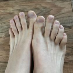 livinggayfeet