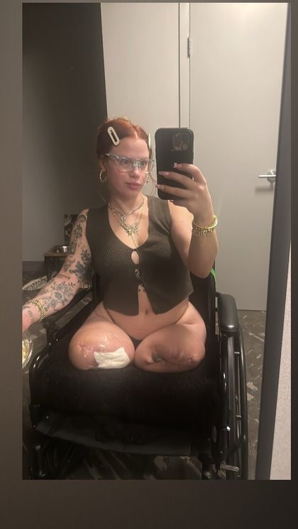 amputeedoll OnlyFans picture