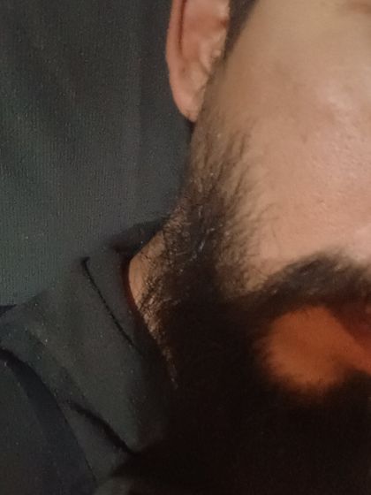 morochote OnlyFans picture