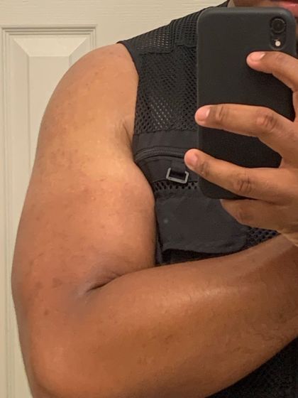hungmidwesterntransplant OnlyFans picture