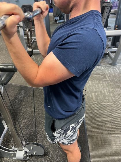vitiligoboy97 OnlyFans picture