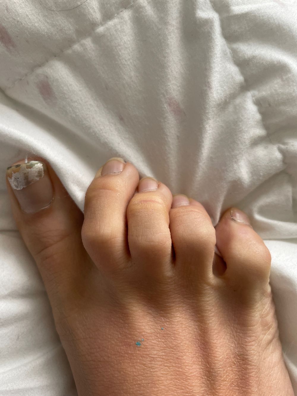 ugly_feet_dirty_street OnlyFans profile picture