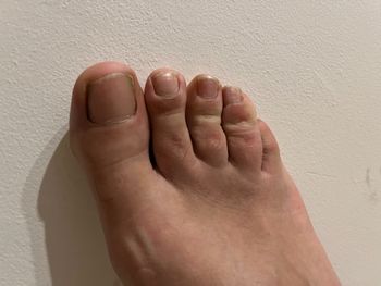 Italian feet