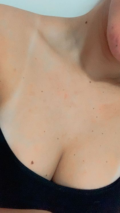 anylins OnlyFans picture