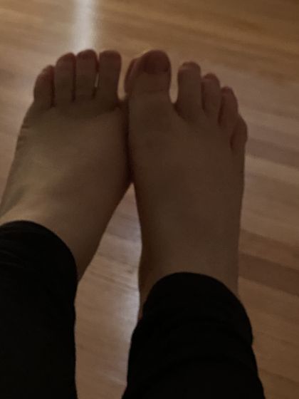 albinopiggies OnlyFans picture