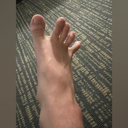 cheenfeet OnlyFans picture