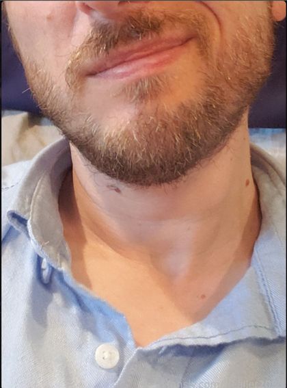 milordhealler OnlyFans picture