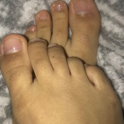 phalanges_only OnlyFans picture