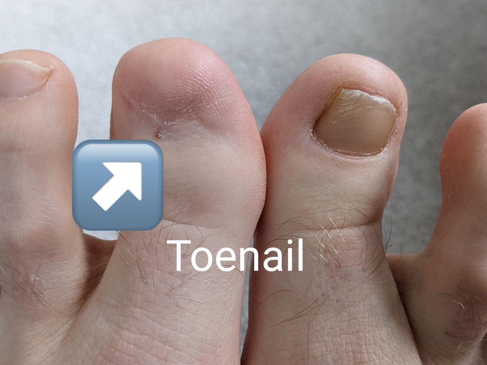toenailguy OnlyFans profile picture