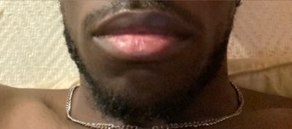 frenchblackbottom OnlyFans picture