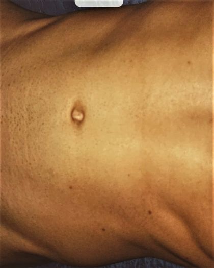 baddmark OnlyFans picture