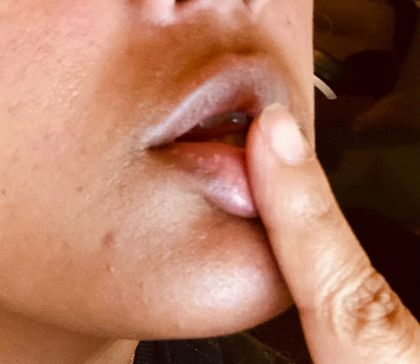 sugar_lipz OnlyFans picture