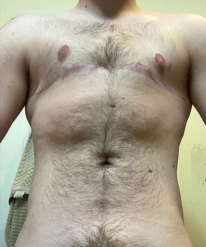 ftm.ethan OnlyFans picture