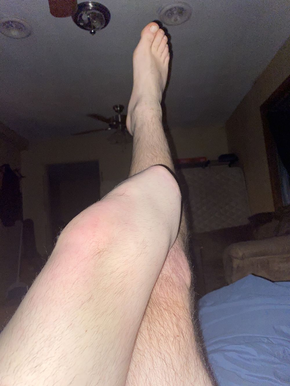 amputeeforlife OnlyFans profile picture