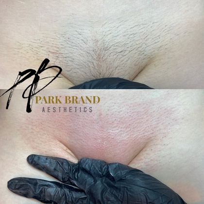 parkbrand OnlyFans picture