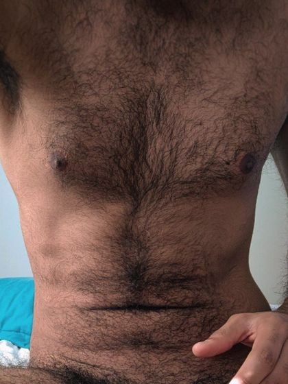 patasfollower OnlyFans picture
