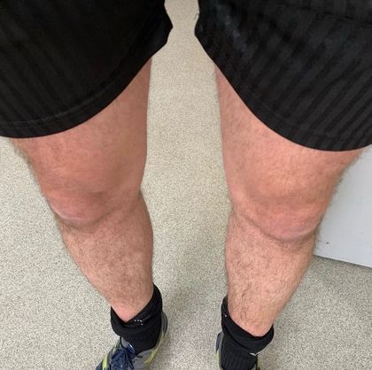 onlylegs88 OnlyFans picture
