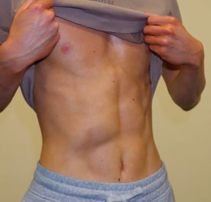 favgymfemboy OnlyFans picture
