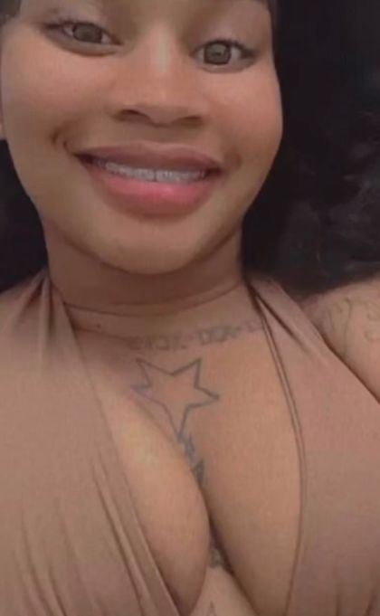 thickbraceface OnlyFans picture