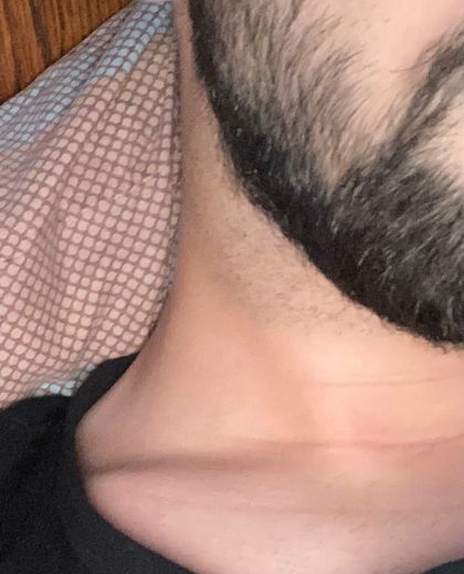 201nch OnlyFans picture