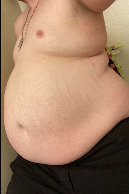 growingballoon OnlyFans picture