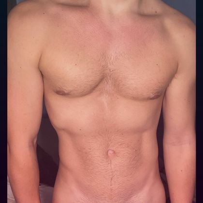 prostatepapi OnlyFans picture