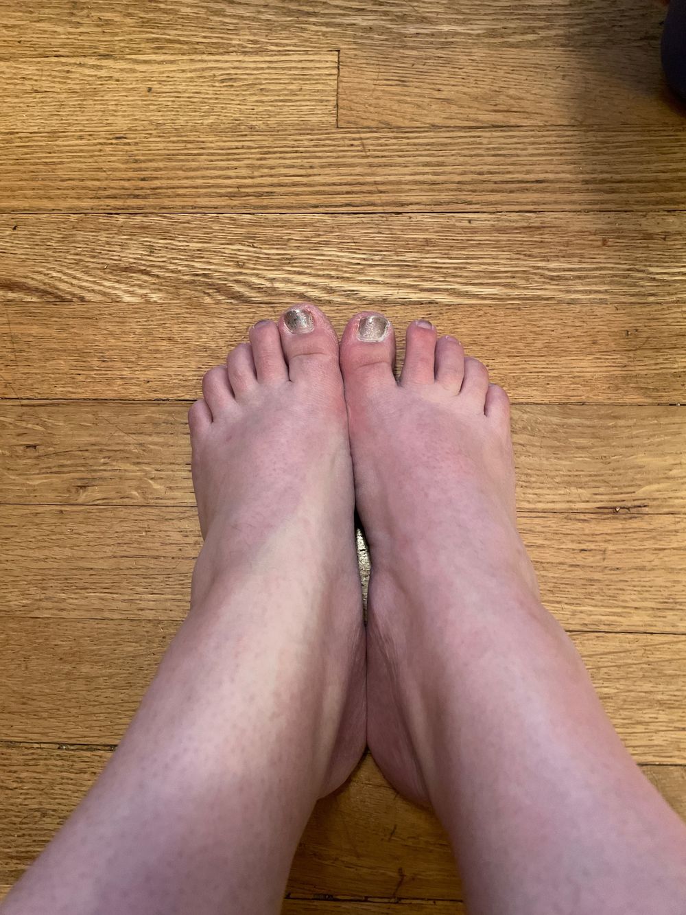 diabeticfeet OnlyFans profile picture