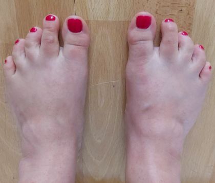 littlecute.toes OnlyFans picture