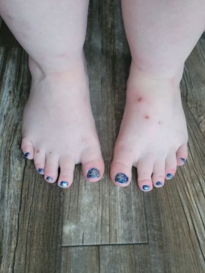 fatfeet95 OnlyFans picture