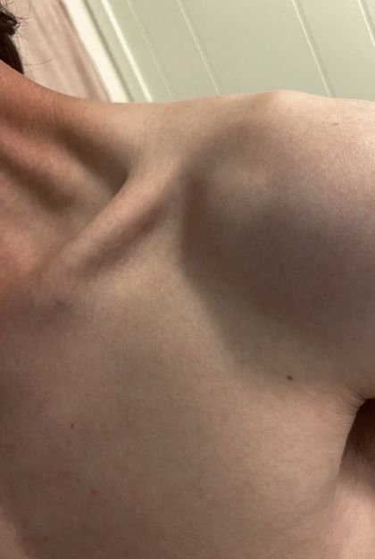 skinnnbonesss OnlyFans picture