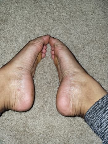 Alkey Toes