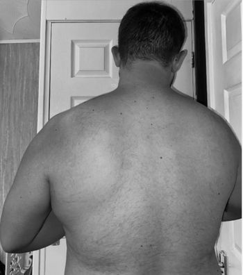 Axel Lynx
