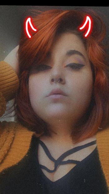 Freckles