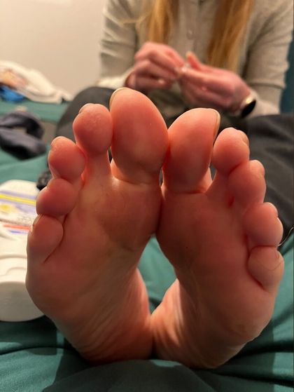 ukgingerfeet83 OnlyFans picture